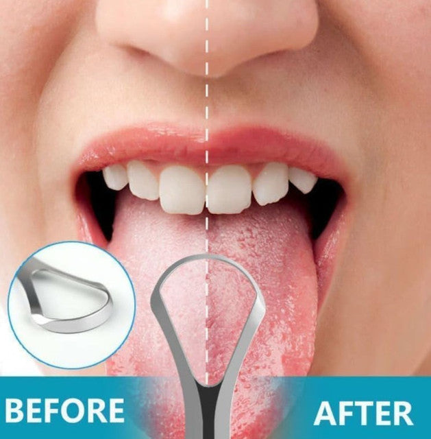 Silver stainless steel tongue scraper set of two for effective daily oral hygiene and residue removal
