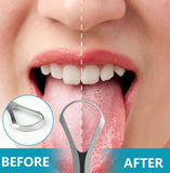 Silver stainless steel tongue scraper set of two for effective daily oral hygiene and residue removal