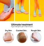 Blue moisturizing cotton heel socks with gel padding for soft and smooth heels