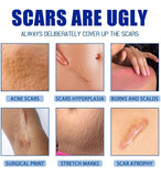 Plastic Scar Removal Cream (White-Blue)