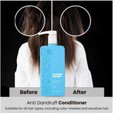 Unisex protein anti-dandruff conditioner (350ml), restores softness, shine, and strength to all hair types on bathroom counter
