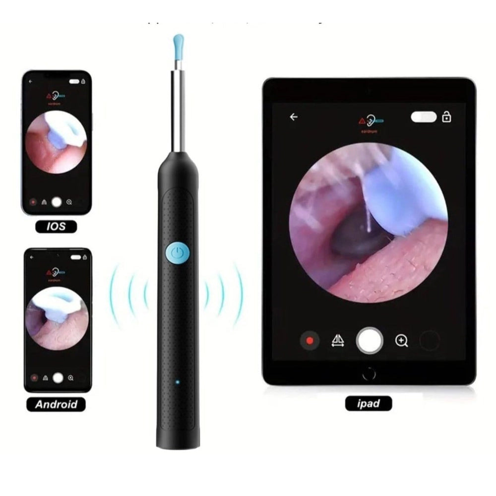 { "alt_text": "Multicolor silicone otoscope camera kit for safe earwax cleaning, nasal and skin inspection tool" }