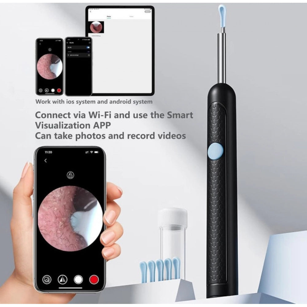 { "alt_text": "Multicolor silicone otoscope camera kit for safe earwax cleaning, nasal and skin inspection tool" }