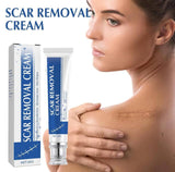 Plastic Scar Removal Cream (White-Blue)