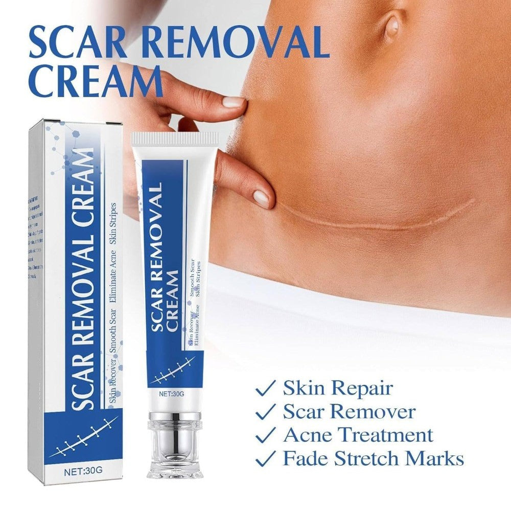 Plastic Scar Removal Cream (White-Blue)