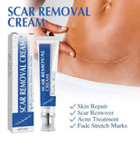 Plastic Scar Removal Cream (White-Blue)