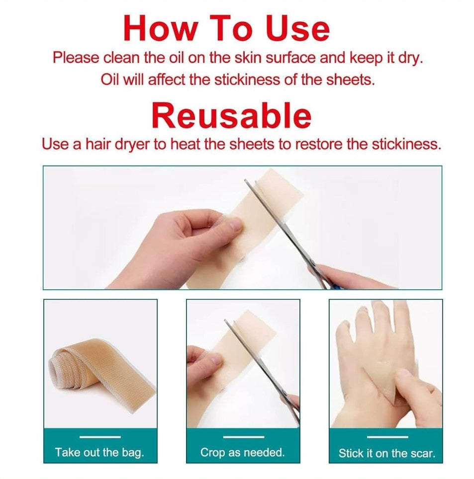 Silicone Scar Tape (Beige)