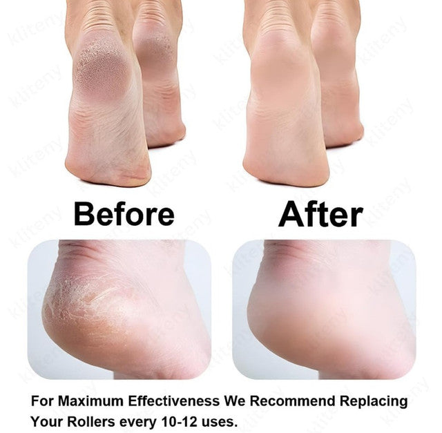 Pink plastic and rubber foot pedi roller with adjustable speeds and LED light for callus removal