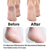 Pink plastic and rubber foot pedi roller with adjustable speeds and LED light for callus removal